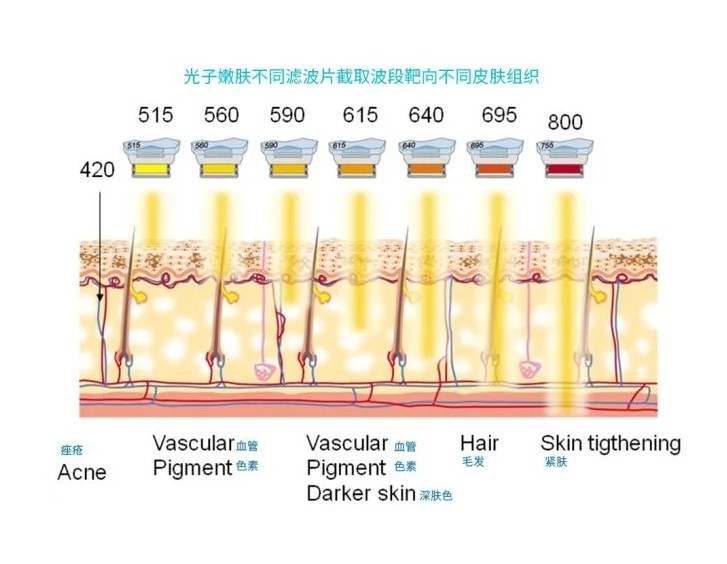 五大光子嫩膚技術(shù)（IPL、DPL、OPT、APT、BBL）及濾光片區(qū)別